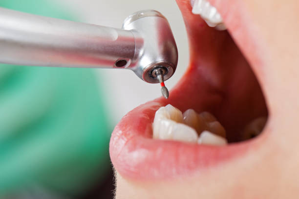 Best Walk-In Emergency Dentist in Foster City, CA
